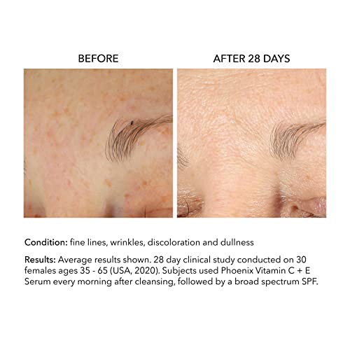 Phoenix 15% Vitamina C & E sérico Cuidados com a pele coreanos Anti envelhecimento Cuidado facial,