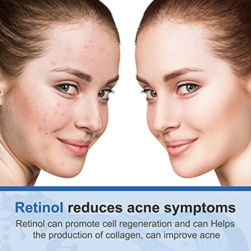 Creme de retinol para o rosto com 2,5% de retinol, ácido hialurônico Vitamina E - Creme de dia e noite de hidratante