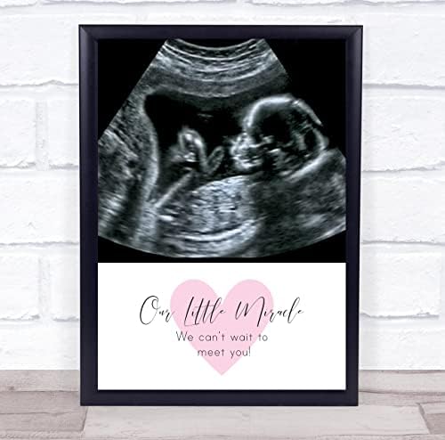Foto de ultrassom de gravidez bebê foto nossa pequena impressão de presente personalizada milagre