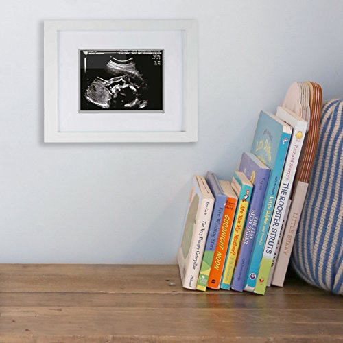 Moldura fotográfica do sonograma de pérola, montagem de parede Uma moldura de imagem de mesa, Ultrassom de bebê lembrança, branco